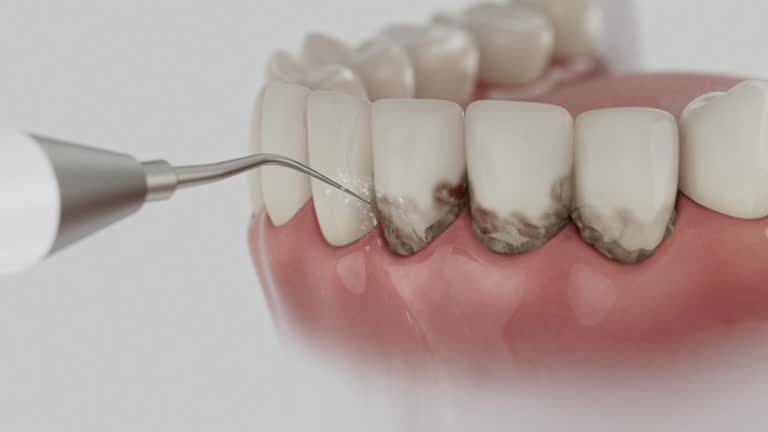 Trusted Emergency Dentist service in Burlington, CO - Dentist Open Now